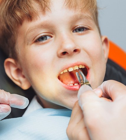 A little boy getting a tooth extracted by a dentist