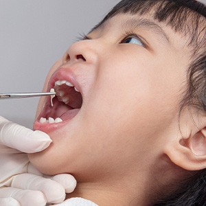 A little girl getting a tooth extraction