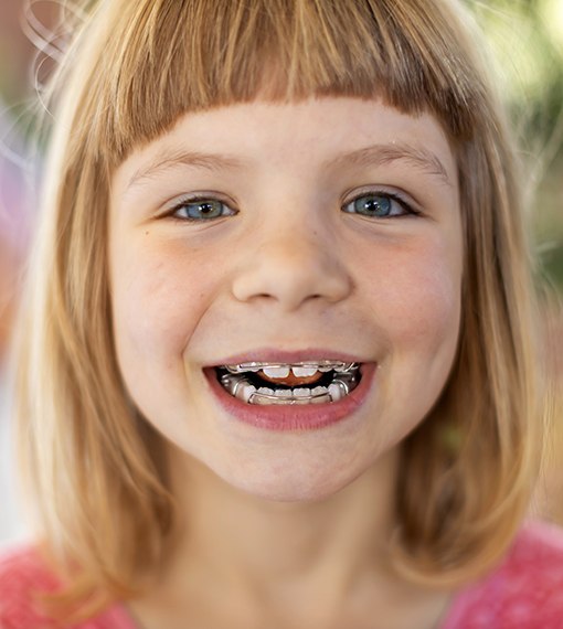 Little girl smiling with Phase 1 Orthodontics in Portland