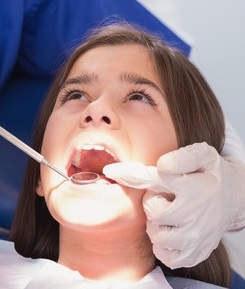 Children’s Dentist Discusses Sealants